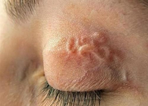 what to do for ringworm in cats